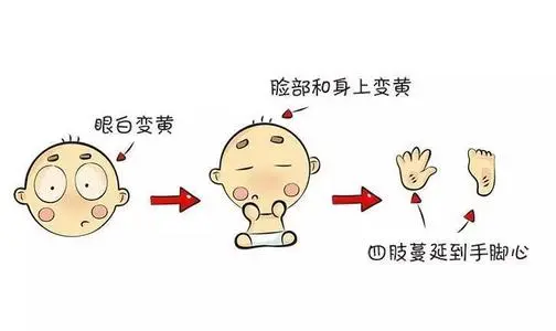 黄疸，应该怎么治？ - 健康资讯- 北京预约挂号平台-耳鼻喉科皮肤科骨科 